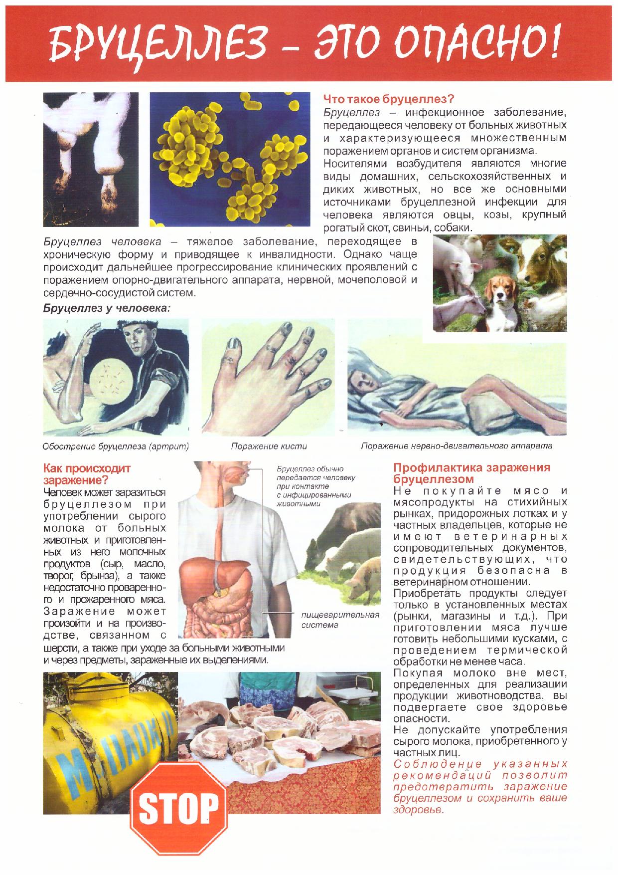 Бруцеллёз — это опасно